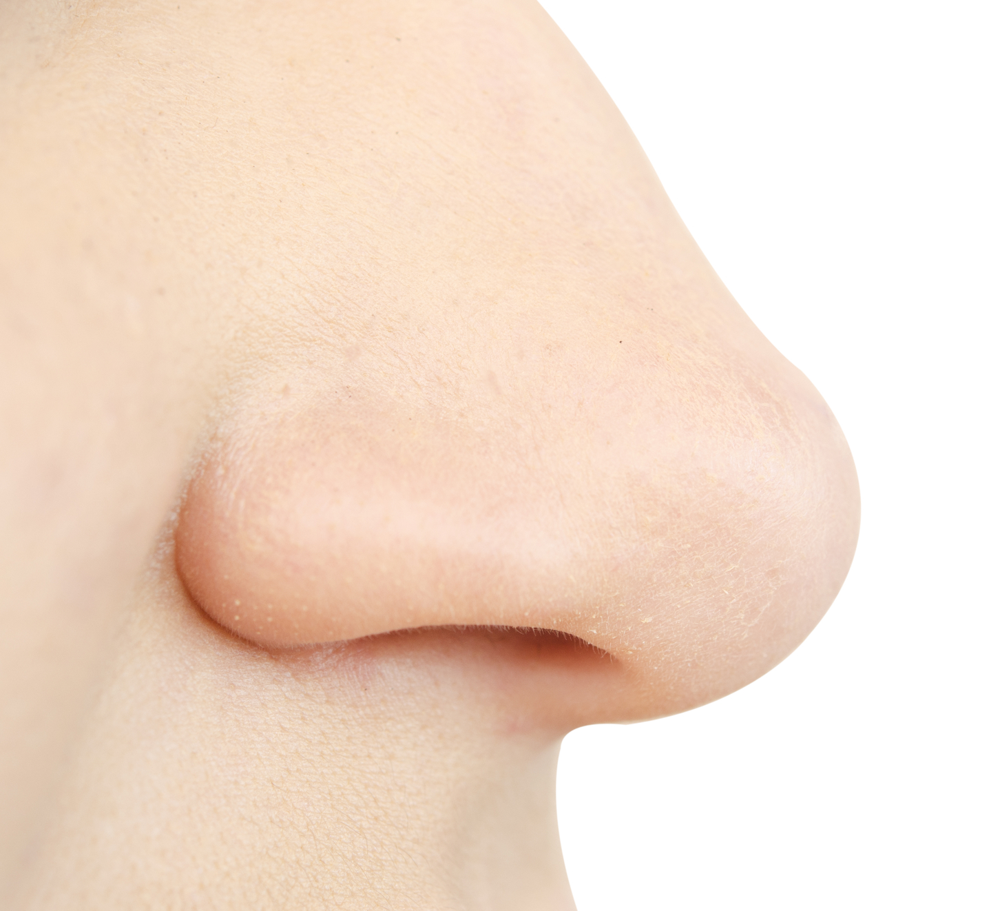 Correction du nez sans chirurgie à beaulieu