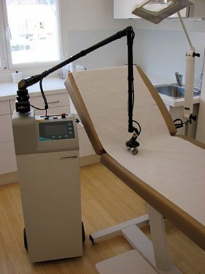 Fractional CO2 laser